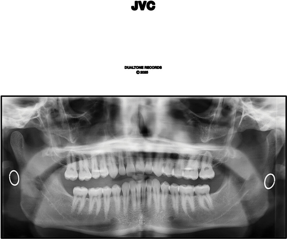 Jvc [LP]