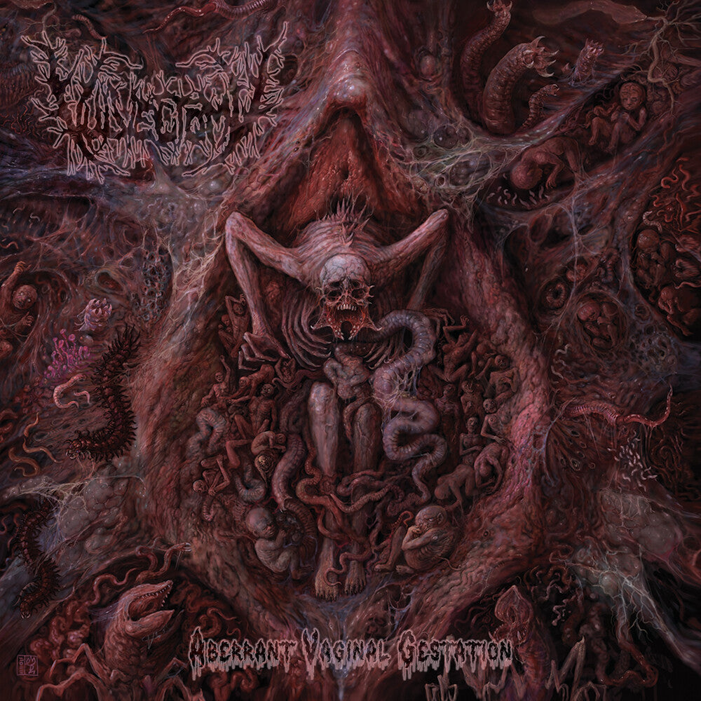 Aberrant Vaginal Gestation [CD]