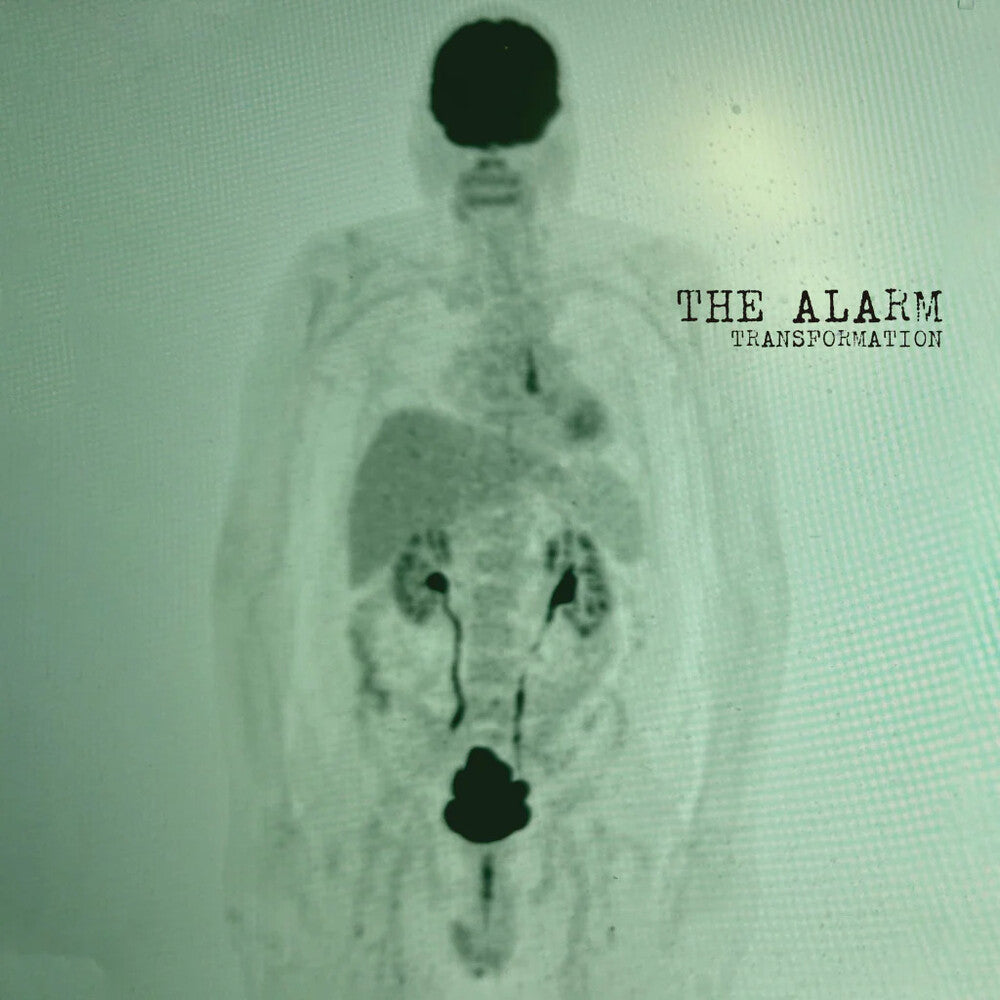 Transformation [LP] (ONLINE ORDER ONLY)