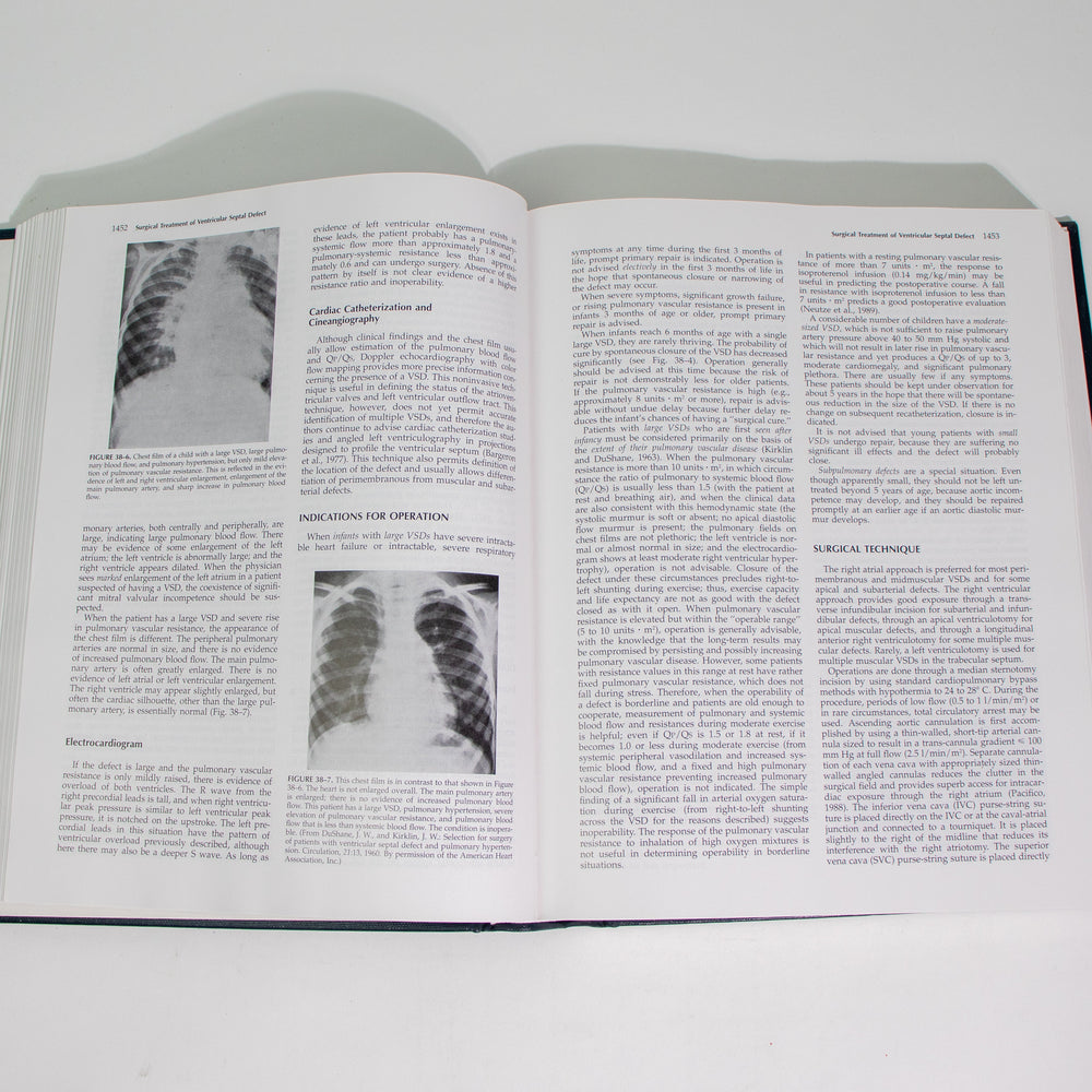 Surgery of the Chest, Sixth Edition, Volume II (ONLINE ORDER ONLY)