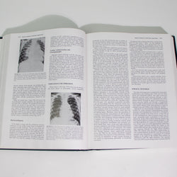 Surgery of the Chest, Sixth Edition, Volume II (ONLINE ORDER ONLY)