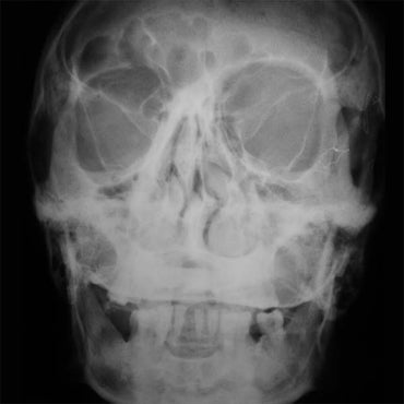 KHOLA COSMICA - Khola Cosmica [Vinyl] (ONLINE ORDER ONLY)